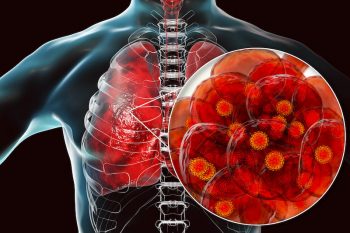 Κορωνοϊός: Έτσι επιτίθεται στους πνεύμονες μέσα σε μια ώρα από την λοίμωξη
